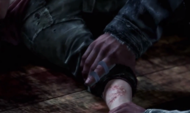 Файл:Ellie's bite.png