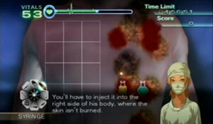 Burn