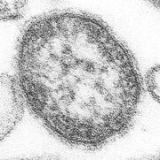 595px-Measles virus