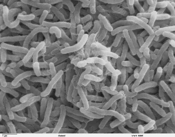 File:Cholera bacteria.jpg