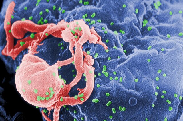 File:HIV.jpg