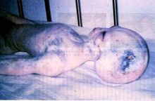 Deadalien