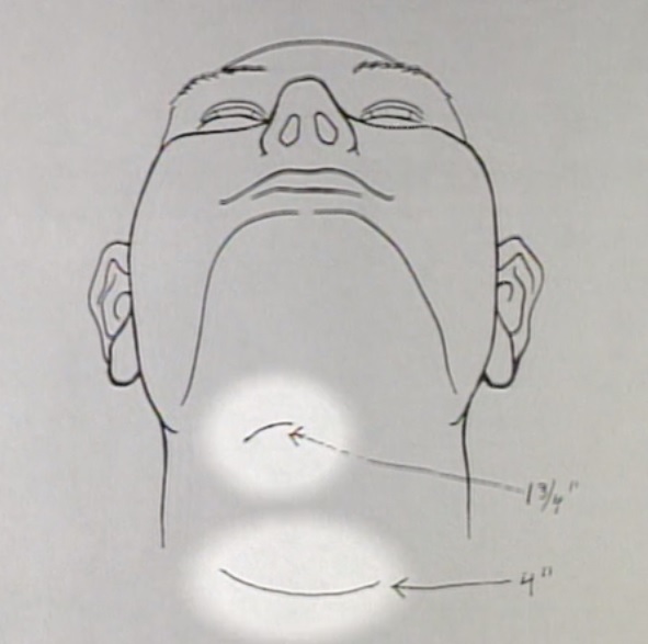 Leroy drieth5 autopsy report