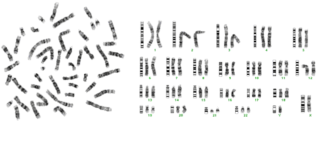 File:G-banding chromosome chart.gif