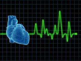 EKG