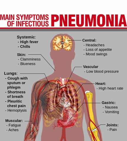 File:Pneumonia.jpg
