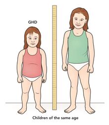 Growth-hormone-deficiency