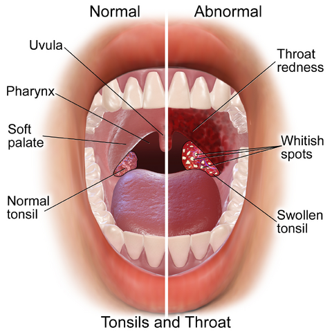 File:Blausen 0860 Tonsils&Throat Anatomy.png