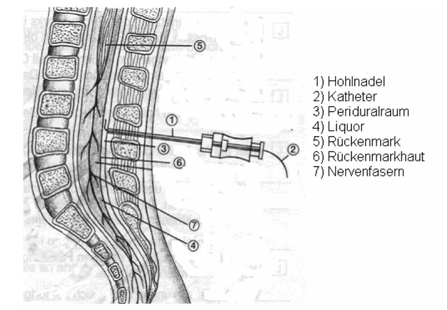 Datei:Olenberger-2009-Abb-1-S-10.png