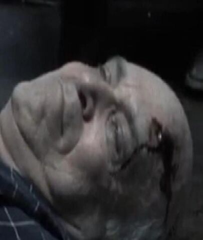 File:Unnamed Patient.jpg