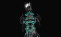 Thumbnail for version as of 23:22, November 24, 2013