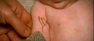 Elora's birthmark