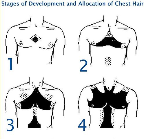 File:622px-Chest hair growth.jpg