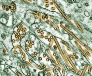 File:Flu slide.jpg